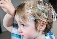 6 Non-Negligible Facts About Children’s Seizures