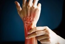 10 Most Common Signs & Symptoms of Gout