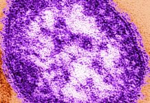 New York Is Facing the Worst Measles Outbreak in Decades