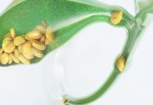 7 Things You Need to Know About Gallbladder Surgery