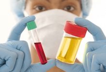 Why Do You Have Gout? Gout Causes & Factors