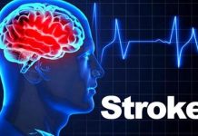10 Causes of Stroke You Need to Know