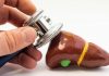 15 Foods of Gallbladder Diet: Allowed & Avoid
