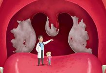 Alarming Triggers of Laryngitis