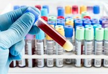 Basic Types of Blood Test