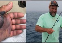 Cases of Flesh-eating Bacteria Increases as an Effect of Climate Change