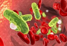 10 Causes of Blood Infection (Septicemia)