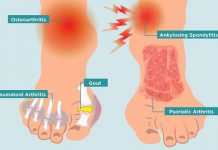 10 Main Causes of Foot Pain