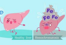 10 Facts about Hemochromatosis