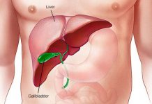10 Common Signs of Pancreatic Cancer