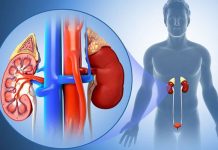 10 Causes of Kidney Disease