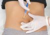 Overactive Bladder – Diagnosis & Treatment