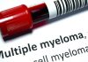 Multiple Myeloma – Stages and Prognosis