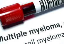 Multiple Myeloma – Stages and Prognosis