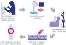 Multiple Myeloma – Diagnosis and Treatment