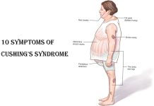 10 Symptoms of Cushing’s Syndrome(Hypercortisolism)