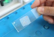 New Studies Show Preferences for Pap Smears over HPV Tests for Cervical Cancer Screening