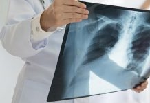 What Is Chronic Bronchitis?