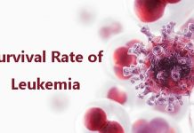 Survival Rate of Leukemia by Type, Age, and More