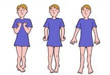 Abnormal Posturing: Types, Causes, and Diagnosis