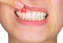 Why Is There Blood in My Saliva