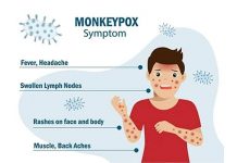 What is Monkeypox – Symptoms, Transmission, Treatments & Prevention