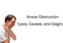 Airway Obstruction: Types, Causes, and Diagnosis