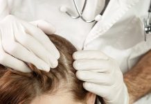 Scalp Psoriasis: Causes, Symptoms, Treatment, and More