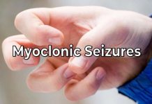 Myoclonic Seizure – What It Is, Symptoms & Treatment