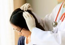 Scalp Psoriasis vs Dandruff – Tips for Identification