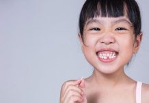 Chipped Teeth and Toddlers: What Parents Need to Know