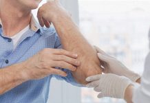 What Conditions Can Be Misdiagnosed as Psoriasis?